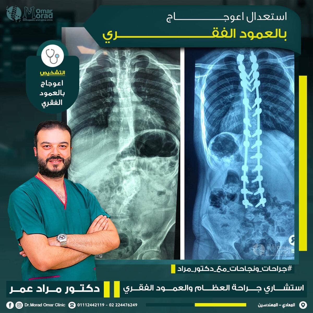 قبل وبعد